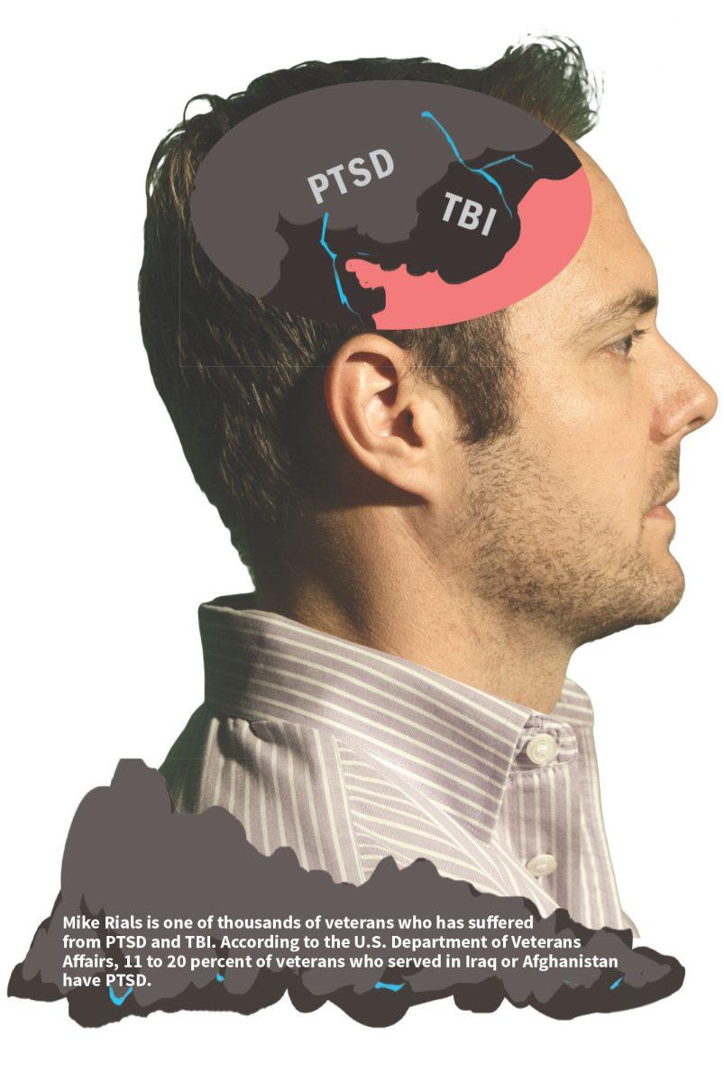 Brain storms